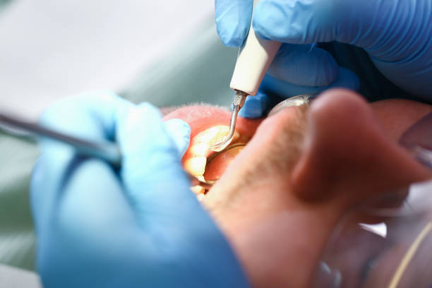 Best Broken Tooth Emergency  in Mead Valley, CA