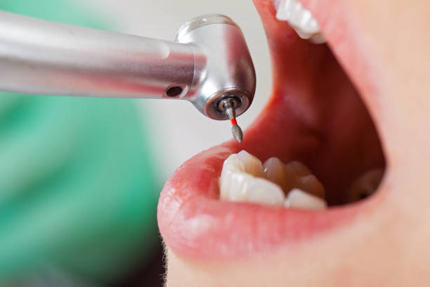 Best Knocked-Out Tooth Emergency  in Mead Valley, CA